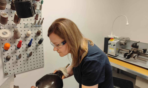 Prosthetics of upper limbs in Ukraine reaches a new level