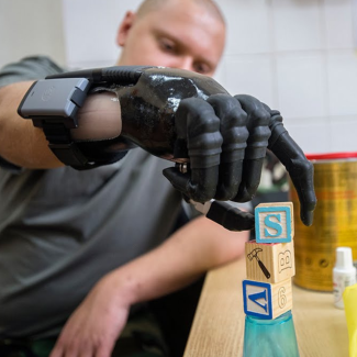protez hub partial hand prosthesis