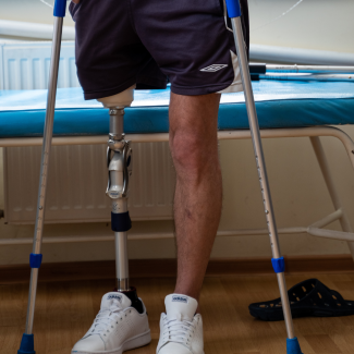protez hub prosthetic leg Ukraine