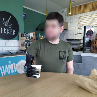protez hub bionic hand