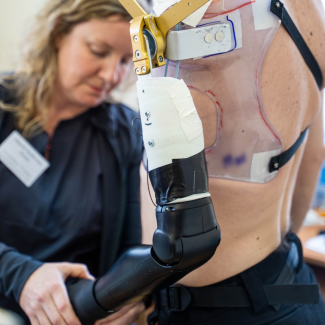 protez hub arm prosthesis Ukraine